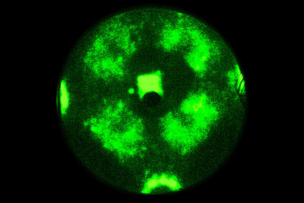 Atomares Muster: Nanopartikel-Mikrokopaufnahme