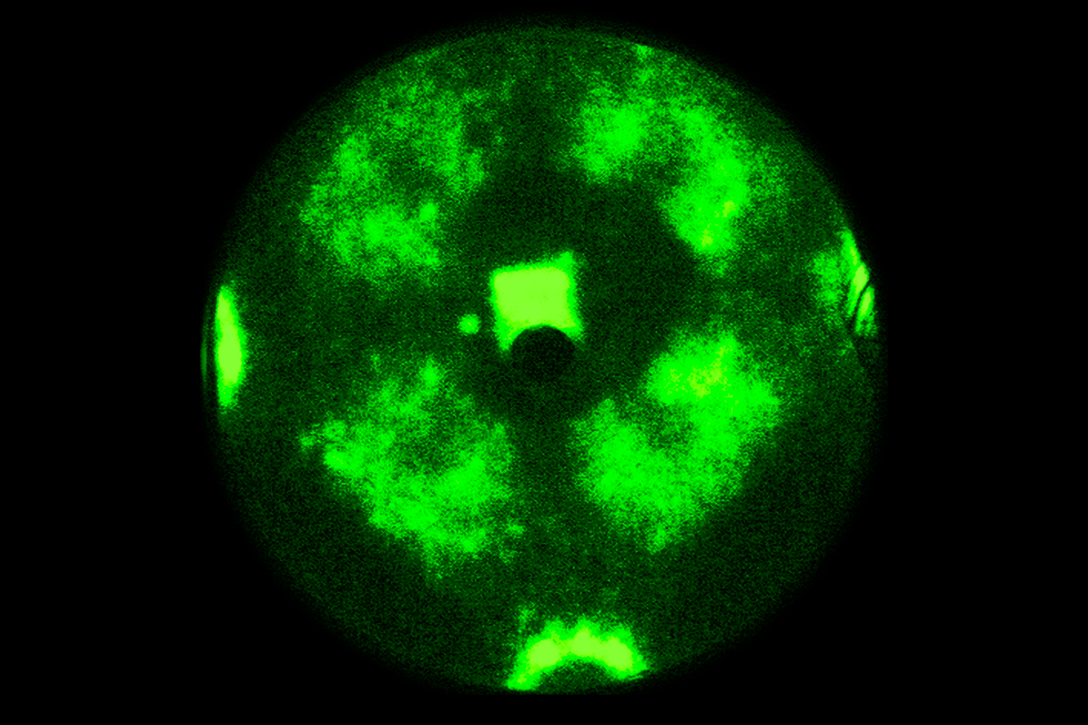 Atomares Muster: Nanopartikel-Mikrokopaufnahme